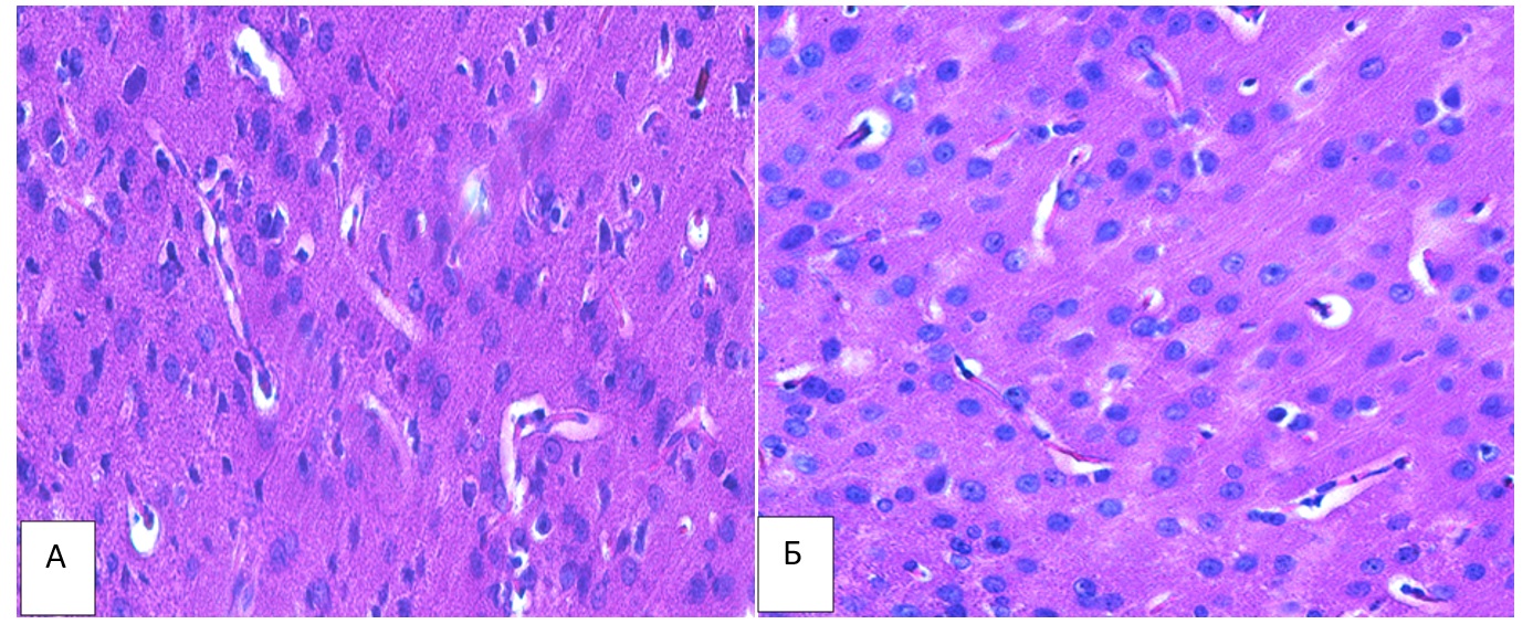 Рис. Ткань головного мозга белых крыс при подостром воздействии SeАГ в дозе 500 мкг/кг. А – опытная группа. Б – контрольная группа. Окраска гематоксилин-эозин. Ув. Х 400.